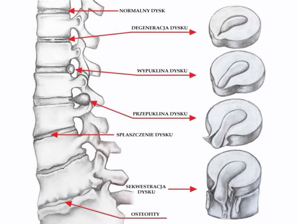 masażysta kręgosłupa wieluń