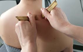 pinoterapia praszka